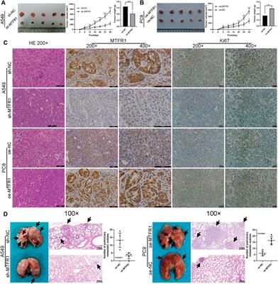 Corrigendum: Negatively regulated by miR-29c-3p, MTFR1 promotes the progression and glycolysis in lung adenocarcinoma via the AMPK/mTOR signalling pathway